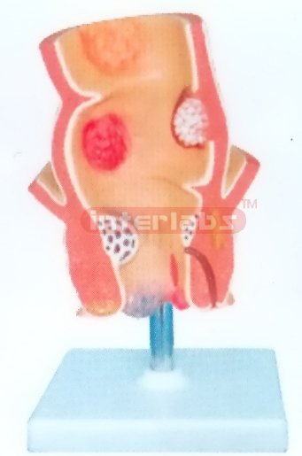 HUMAN RECTUM MODEL